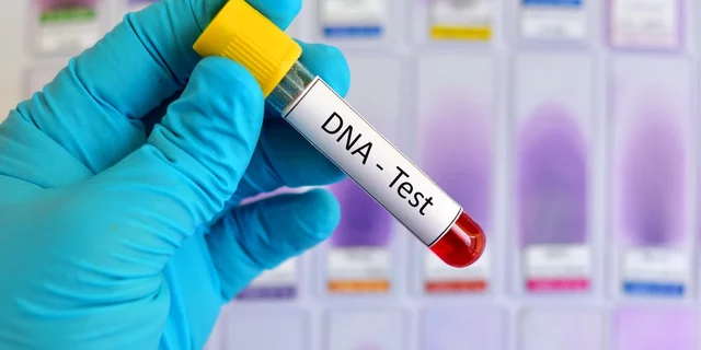 DNA testing